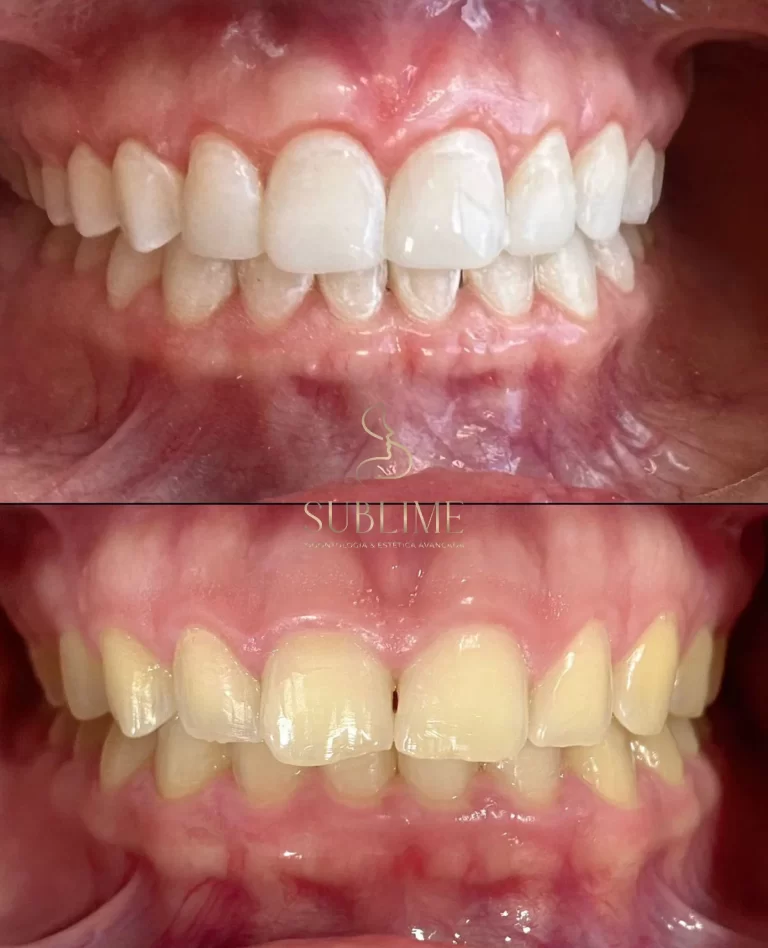 periodental2