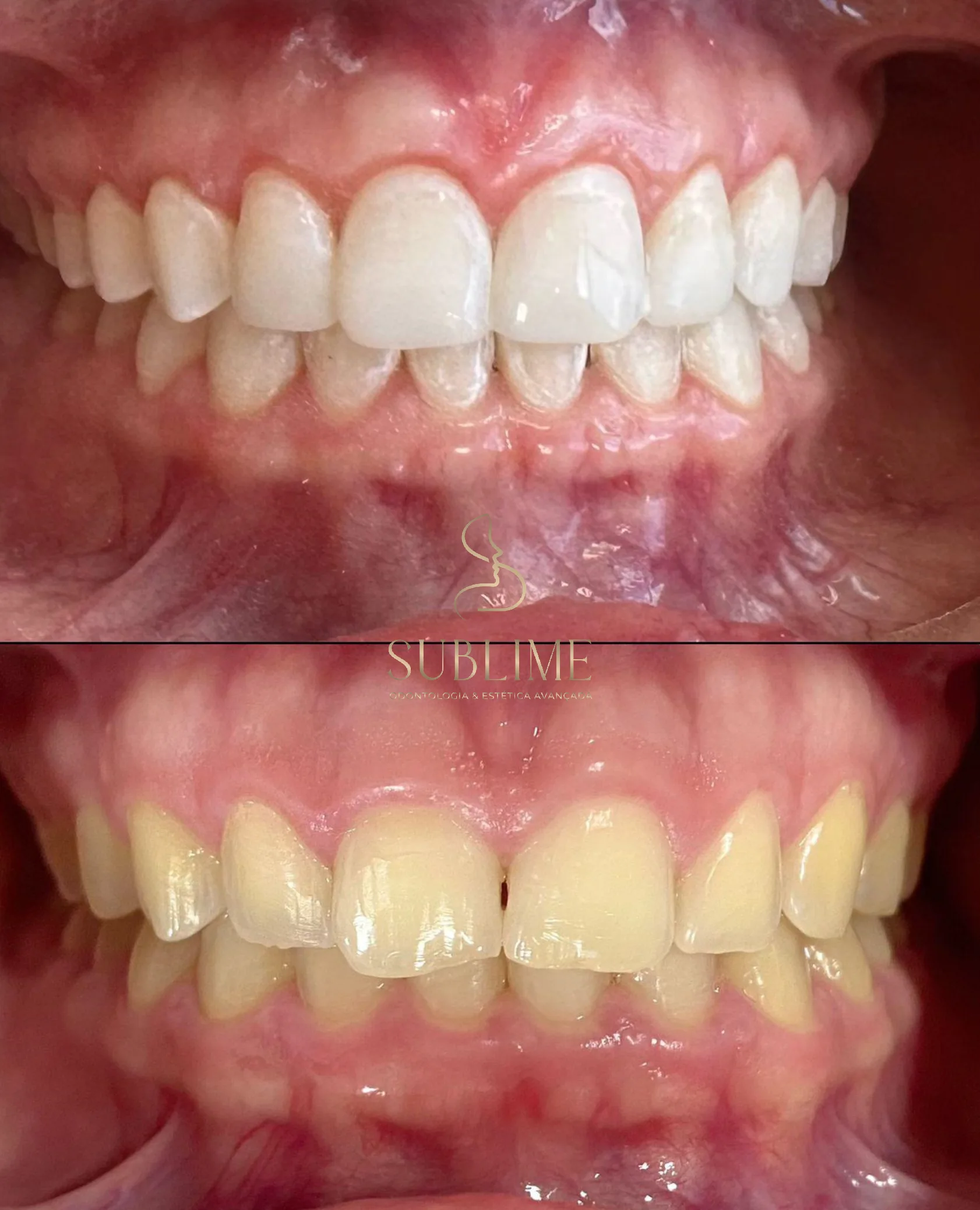 periodental2