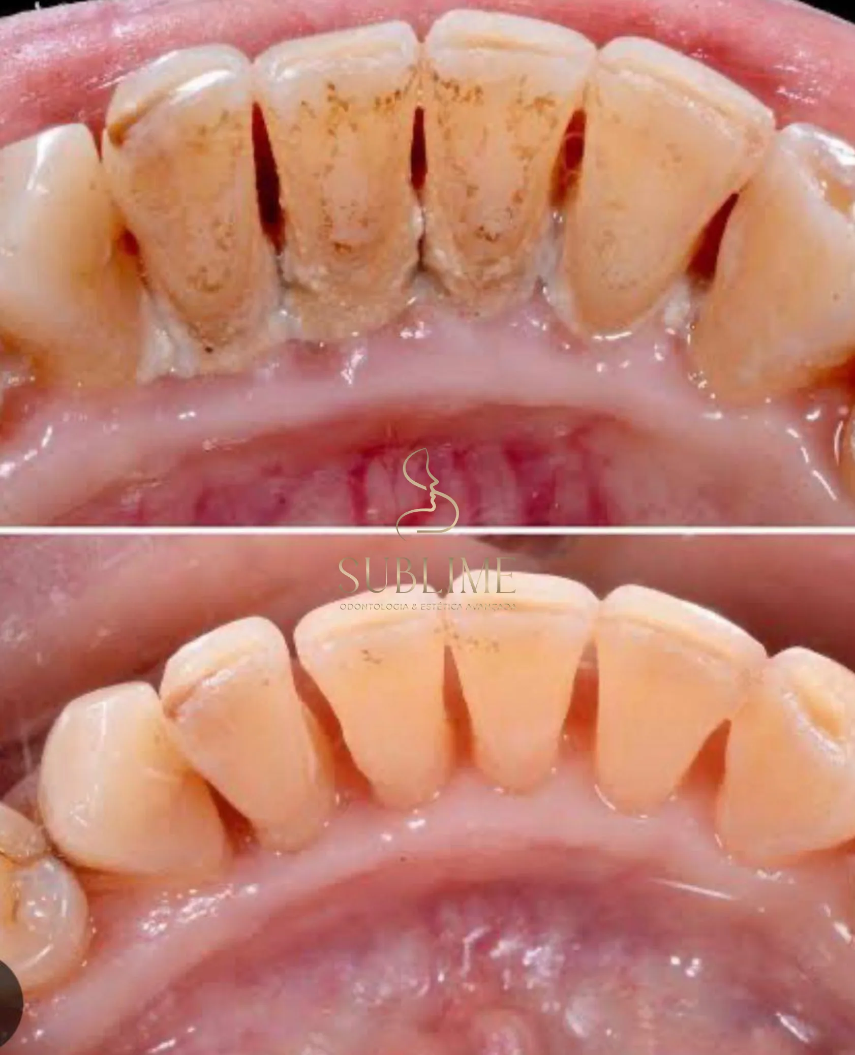 periodontal